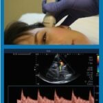 TCD_PacificVascular